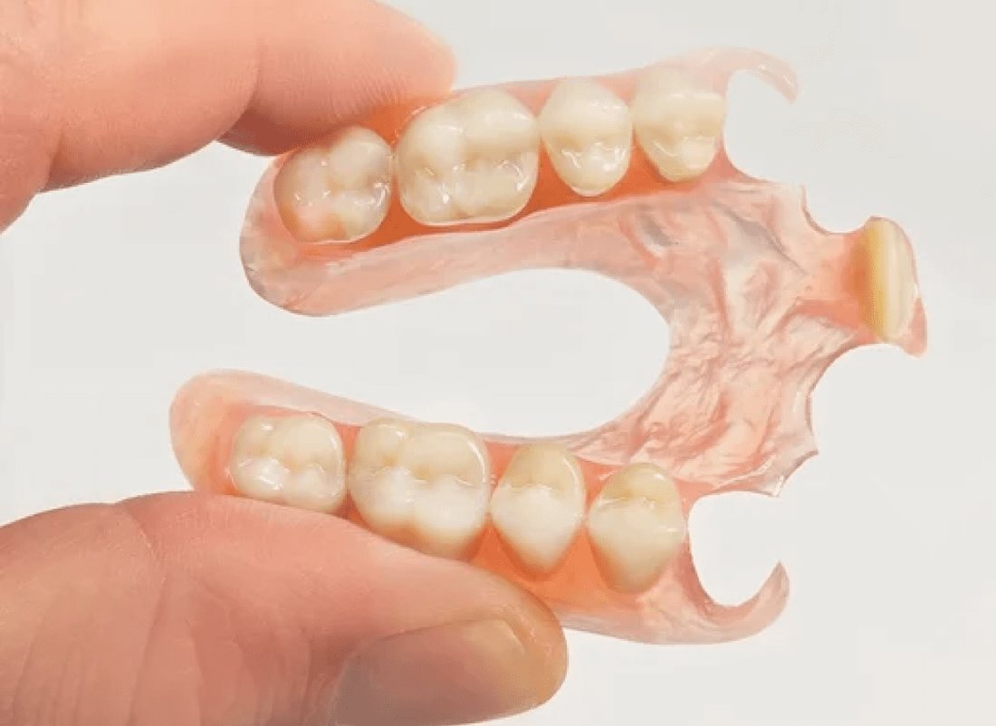 A flexible nylon partial denture